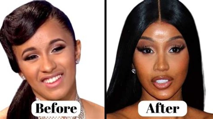 Alondradessy Before BBL | Plastic Surgery Transformation