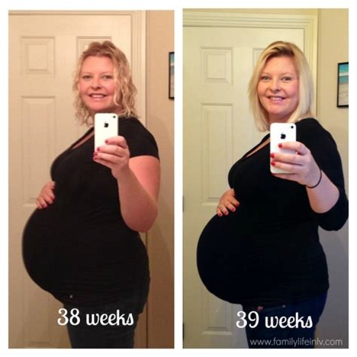 Before & After Photos Pregnancy