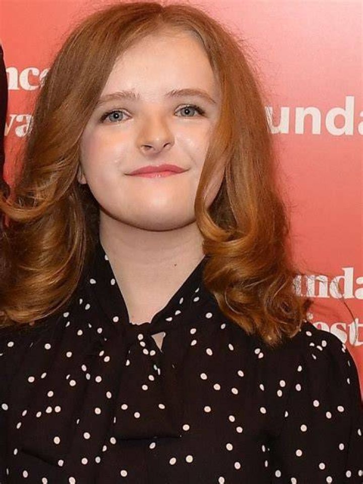 Does Milly Shapiro Have Down Syndrome