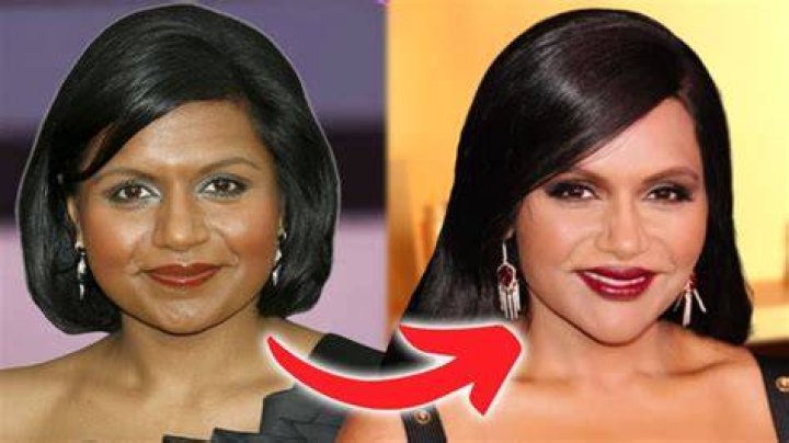 Mindy Kaling Plastic Surgery